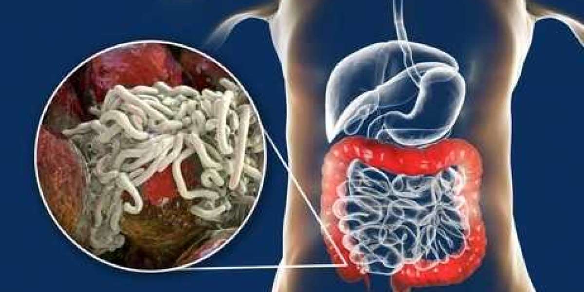 Wormiza 222 mg – Advanced Parasite Control for Human